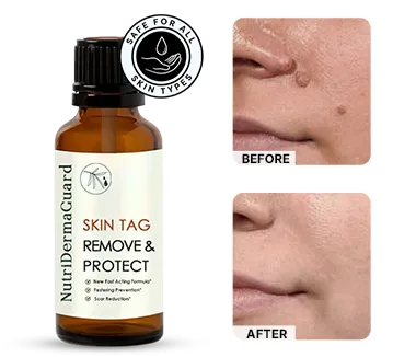 NutriDerma Guard Discount